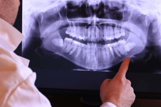 Best Cracked Tooth Emergency Dentist  in Rancho Cumonga, CA